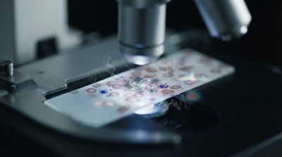 金澤大學研發新法 胰臟癌早期檢測率達九成
