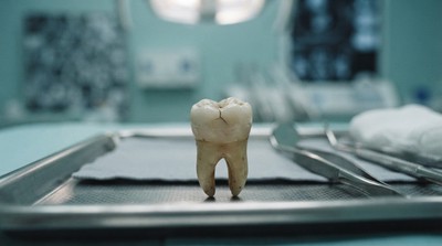 口腔健康藏警訊：口臭磨牙恐洩壓力、飲食與生活惡習
