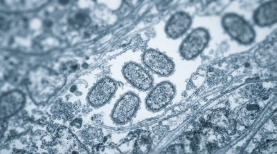 肯亞Mpox疫情升溫 累計近1300例19死 衛生部籲強化防疫