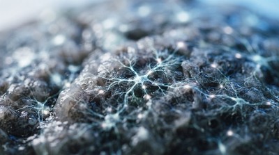 耶魯醫學院獲近2500萬美元補助　繪製大腦圖譜推進自閉症研究
