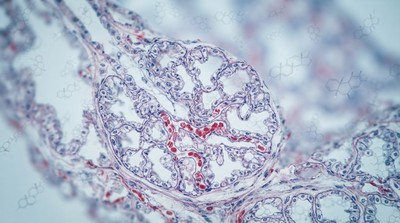 英國艾希特大學啟動罕見肺病全球首創研究 盼革新治療