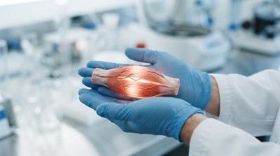 專家呼籲肌肉健康應成臨床營養核心　不只體重下降也應顧肌力
