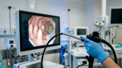 馬來西亞KPJ醫療體系引進AI輔助結腸鏡　強化大腸癌早期偵測